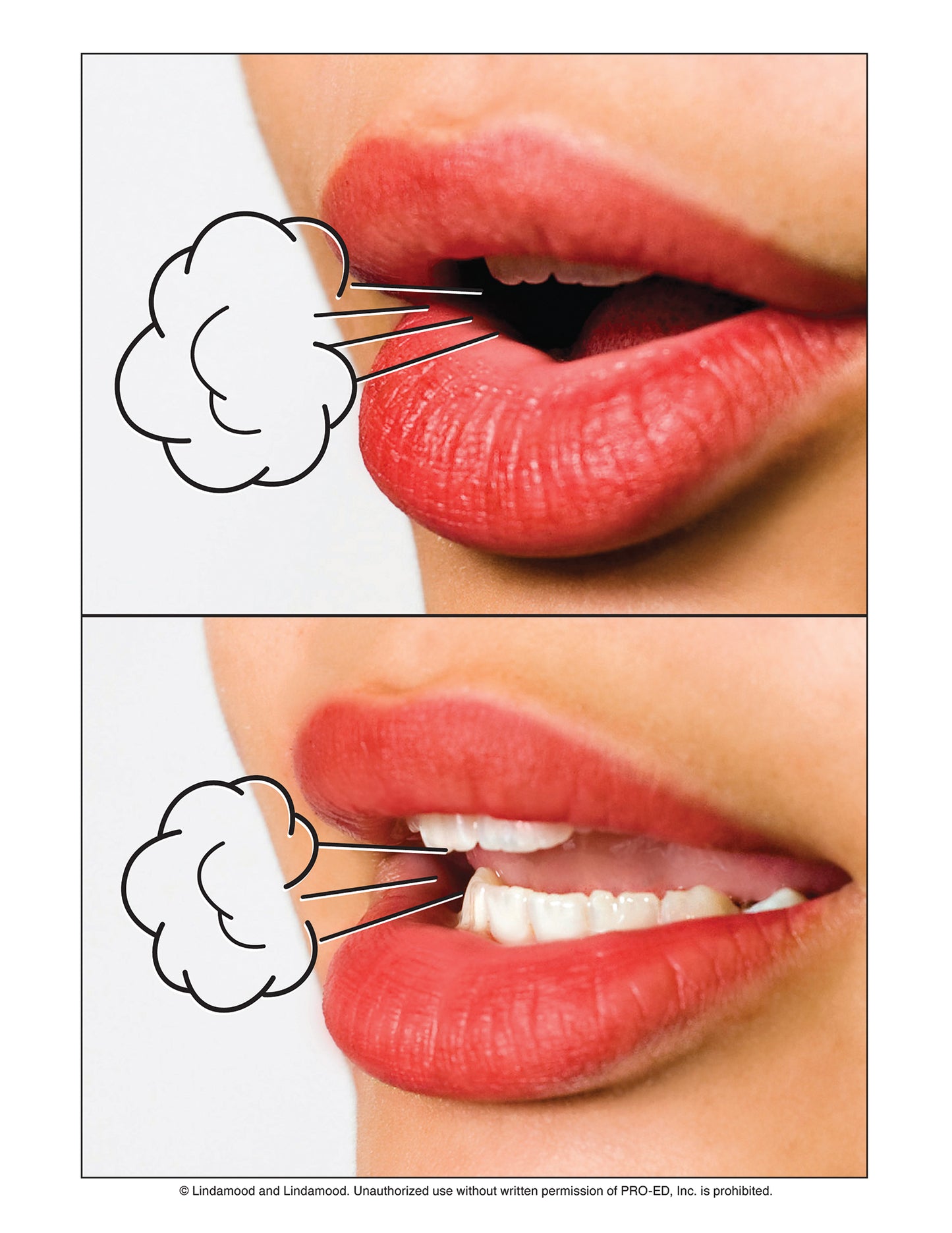 LiPS® Large Mouth Pictures