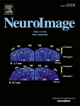 Neuroimage journal cover